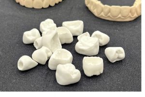 روکش‌های سرامیکی دندان پرینت سه بعدی شده 